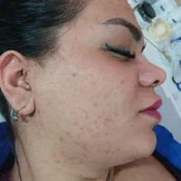 فیشال تخصصی پوست و اپیلاسیون کل بدن