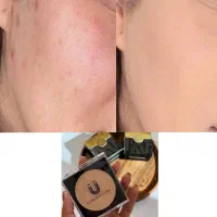 لوازم آرایشی پنکک لاکچری کوین اصل