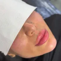 فیلر زل بوتاکس مزو بایو فیس لیفت پر کننده50/|خدمات آرایشگری و زیبایی|مشهد, هفت تیر (حافظ)|دیوار