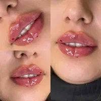 آموزشب وتاکس ژل فیلر نخ لیفت لیزر مو طب سنتی فشیال|خدمات آموزشی|اصفهان, جلفا|دیوار
