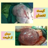 مثل کره چربی سوزی کن|آرایشی، بهداشتی، درمانی|مشهد, دانشجو|دیوار