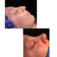 اا بینی و زیبایی ۳۷ تومن