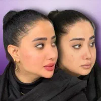 تزریق ژل بوتاکس لیفت مادلینگ و کانتورینگ کلینیک|خدمات آرایشگری و زیبایی|بندرعباس, |دیوار