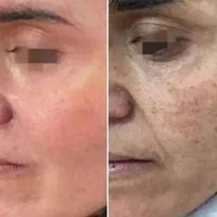 کرم گلدن شاین طلایی اصلی گلدن کویین|آرایشی، بهداشتی، درمانی|شیراز, شهرک ولیعصر|دیوار