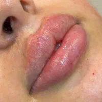 جشنواره زیبایی((مدل ژل وبوتاکس))|خدمات آرایشگری و زیبایی|سنندج, |دیوار