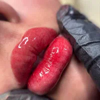 تخفیف ویژه شیدینگ لب فقط تا پایان فروردین