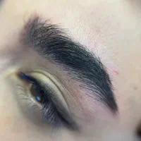 مدل میکروبلیدینگ