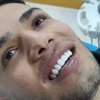 بلیچینگ۳ جرمگیری ۴۰۰پالیش۹۰۰