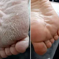 پدیکورتخصصی350آموزش پدیکور پاکسازی دست نوبهار|خدمات آرایشگری و زیبایی|کرمانشاه, |دیوار