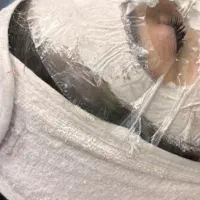 پاکسازی وفیشال پوست