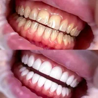 جشنواره عیدانه دندانپزشکی