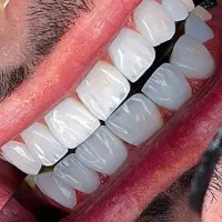 کامپوزیت و لمینیت