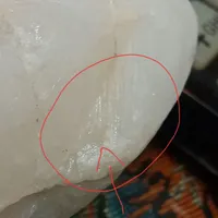 سنگ عتیقه