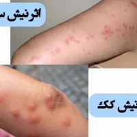 سمپاشی صدردصد‌تضمینی‌سم پاشی‌سوسک‌وساس و...|خدمات نظافت|تهران, آذری|دیوار