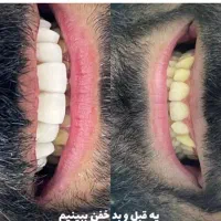 انجام کلیه خدمات دندانپزشکی قرارداد بانک سپه ورفاه|خدمات آرایشگری و زیبایی|فلاورجان, |دیوار