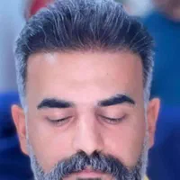 کاشت مو ابرو ریش بدون جراحی ضمانتنامه مادام العمر