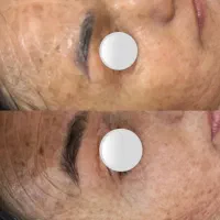 پاکسازی ۱۲مرحله با هدیه درما ۱۹۸ تومان( کلینیک)|خدمات آرایشگری و زیبایی|بیرجند, |دیوار