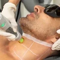 لیزر موهای زائد غیرتماسی کندلا|خدمات آرایشگری و زیبایی|دوگنبدان, |دیوار