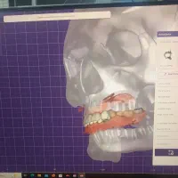 اموزش طراحی دیجیتال دندان(اگزوکد)