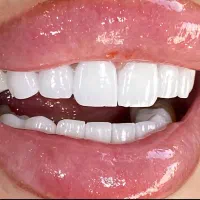 کامپوزیت دندان|خدمات آرایشگری و زیبایی|پرند, فاز ۶|دیوار