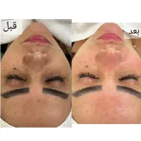 فیشال وی ای پی ۵۰۰|خدمات آرایشگری و زیبایی|بندرعباس, |دیوار