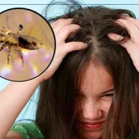 پاکسازی کامل مو بادستگاه تخصصی ضد شپش وموخوره گیری