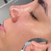 مژده مژده تخفیف فشیال و پاکسازی پوست فقط ۱۹۰تومن|خدمات آرایشگری و زیبایی|مشهد, طبرسی شمالی|دیوار