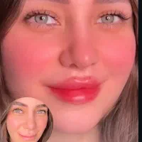 مادلینگ فول فیس ۹/۹۰۰توسط پزشک مدت محدود