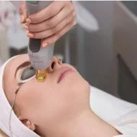 لیزر موهای زائد با۴۰٪تخفیف
