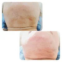 الکترولیز بانوان (رفع دائمی موهای زائد صورت و بدن)|خدمات آرایشگری و زیبایی|شیراز, گویم|دیوار