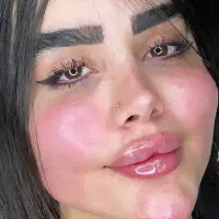 ژل/بوتاکس/چربی/مزوژل/وآموزش گروهی وخصوصی|خدمات آرایشگری و زیبایی|اهواز, گلستان|دیوار