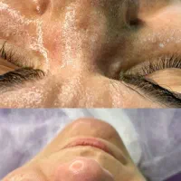 فشیال|خدمات زیبایی و سلامت|رشت, جهاد|دیوار