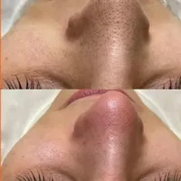 پاکسازی پوست و پارافین تراپی ۳۰۰