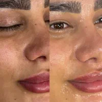 فیشال و(پاکسازی پوست)آبرسانی پوست|خدمات آرایشگری و زیبایی|رفسنجان, |دیوار