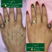 فیشیال و آلگاپیل و خالبرداری و هایفرکوئنسی|خدمات آرایشگری و زیبایی|شیراز, شریف‌آباد|دیوار