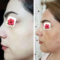 کرم عربی ۴۵ترکیب گیاهی جدیدترین کرم سال|آرایشی، بهداشتی، درمانی|یزد, |دیوار