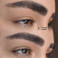 میکرو بلیدینگ