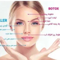 آموزش خدمات ژل و فیلر