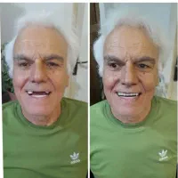 دندانپزشکی دندانسازی متد جدید یک روزه در شهر ساوه