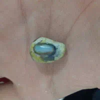 سنگ قیمتی چشم اژدها