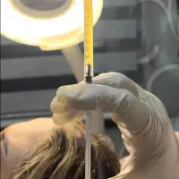 پی آر پی حجامت امبدینگ طب سوزنی زالو بادکش