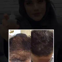 آقایون بالای ۱۷ سال