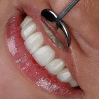 خدمات لابراتوآر دندانپزشکی*هنر دنت*