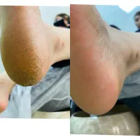 پدیکور تخصصی