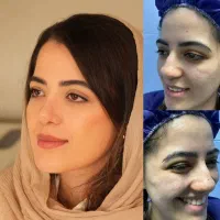 جشنواره عمل بینی در تهران برای خرمشهری ها/۴۳تومن
