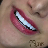 کامپوزیت ارزان|پزشکی|تهران, شهرک خرازی|دیوار