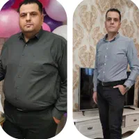 جراحی چاقی.اسلیو.بای پس،پیکرتراشی