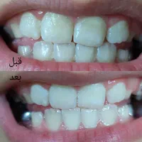 برای استفاده شخصی پک دهان دندان|آرایشی، بهداشتی، درمانی|گلوگاه بابل (گلیا), |دیوار