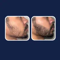 ریش ۲|آرایشی، بهداشتی، درمانی|برازجان, |دیوار
