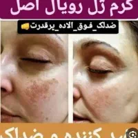 کرم ژل رویال روشن کننده پوست|آرایشی، بهداشتی، درمانی|تربت‌حیدریه, آغوی|دیوار